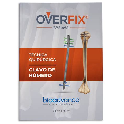 duosecant overfix